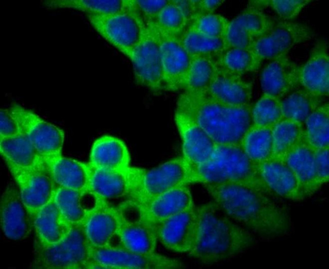 USP9X Antibody in Immunocytochemistry (ICC/IF)