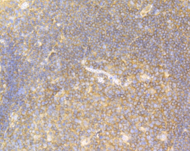 USP9X Antibody in Immunohistochemistry (Paraffin) (IHC (P))