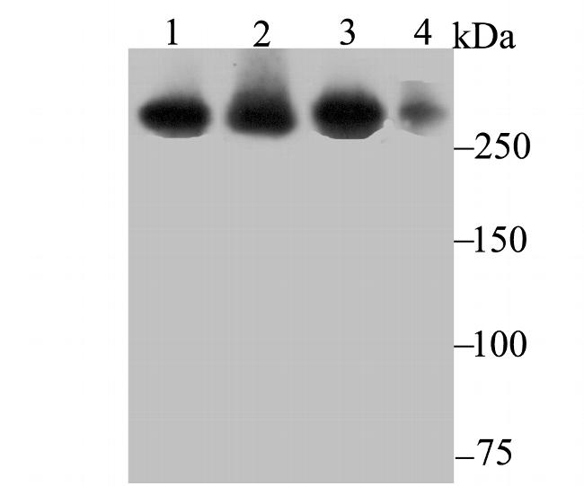 USP9X Antibody in Western Blot (WB)