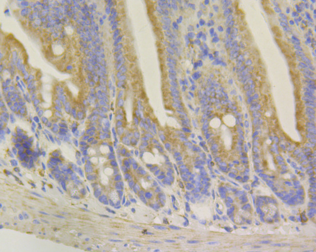 Syntrophin alpha-1 Antibody in Immunohistochemistry (Paraffin) (IHC (P))