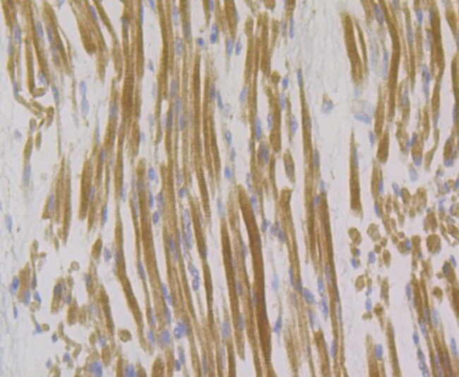 Syntrophin alpha-1 Antibody in Immunohistochemistry (Paraffin) (IHC (P))