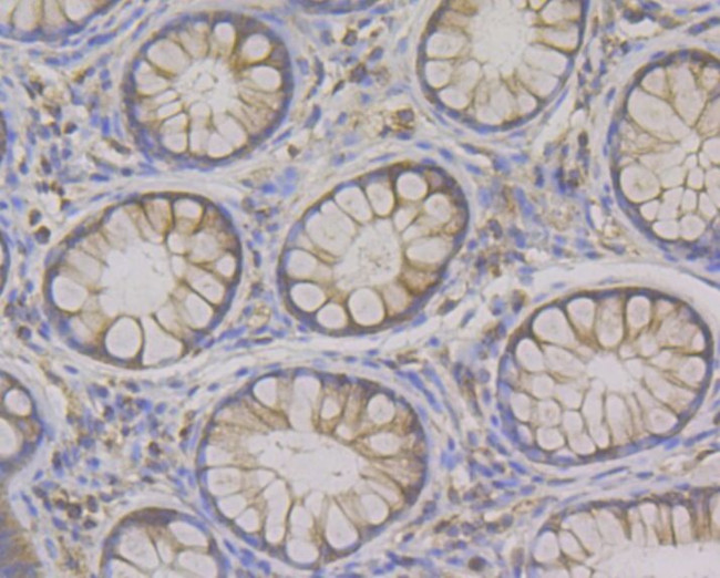 Syntrophin alpha-1 Antibody in Immunohistochemistry (Paraffin) (IHC (P))