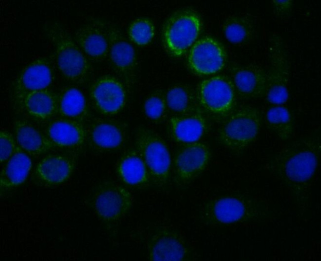 TREX1 Antibody in Immunocytochemistry (ICC/IF)