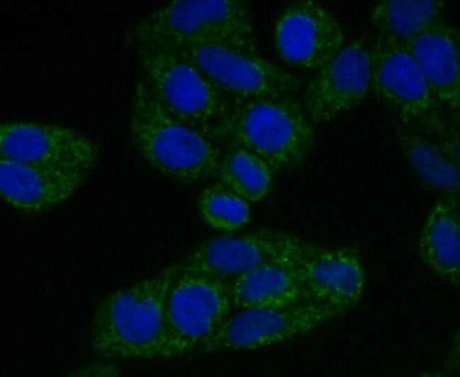 TREX1 Antibody in Immunocytochemistry (ICC/IF)