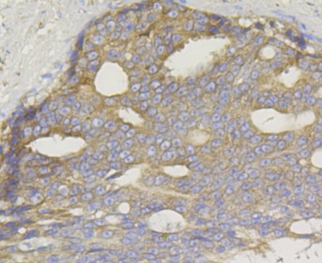 TREX1 Antibody in Immunohistochemistry (Paraffin) (IHC (P))