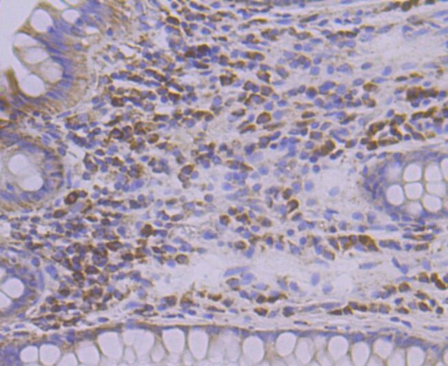 TREX1 Antibody in Immunohistochemistry (Paraffin) (IHC (P))