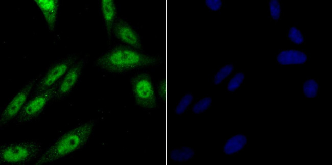 PRP8 Antibody in Immunocytochemistry (ICC/IF)