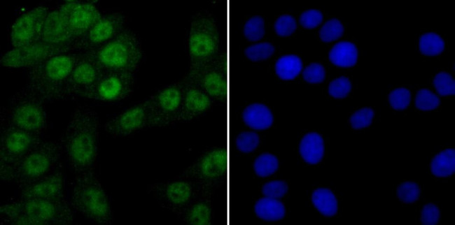 PRP8 Antibody in Immunocytochemistry (ICC/IF)