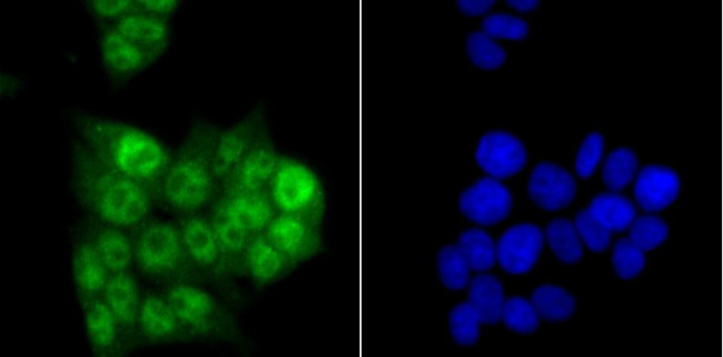 PRP8 Antibody in Immunocytochemistry (ICC/IF)