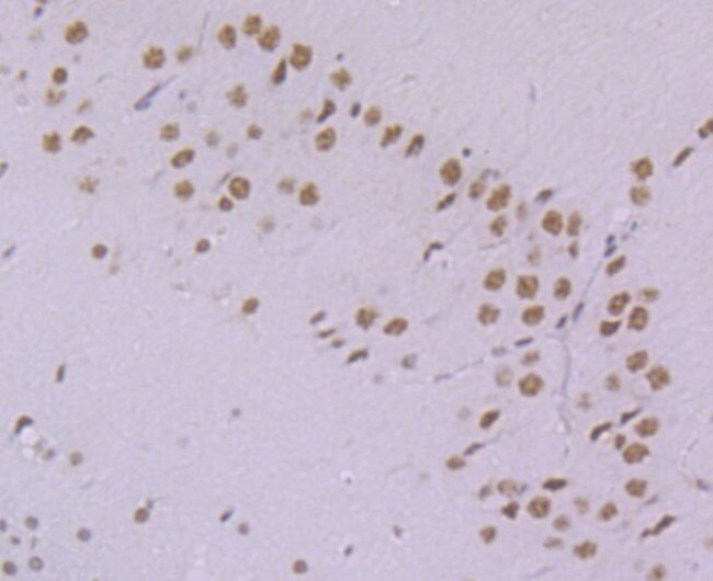 PRP8 Antibody in Immunohistochemistry (Paraffin) (IHC (P))