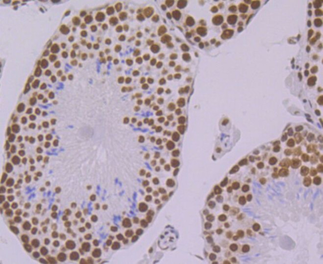 PRP8 Antibody in Immunohistochemistry (Paraffin) (IHC (P))