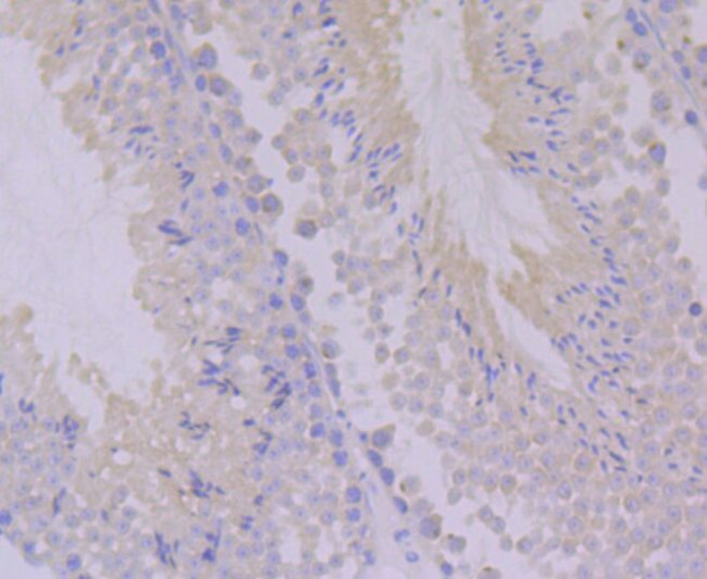 PON2 Antibody in Immunohistochemistry (Paraffin) (IHC (P))