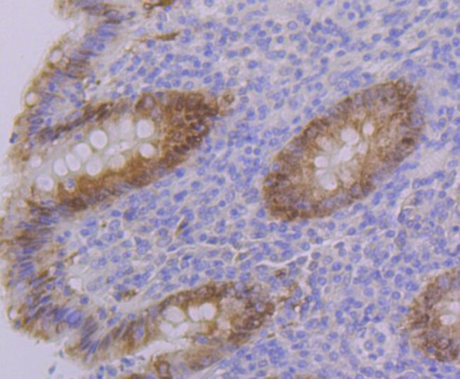 PON2 Antibody in Immunohistochemistry (Paraffin) (IHC (P))