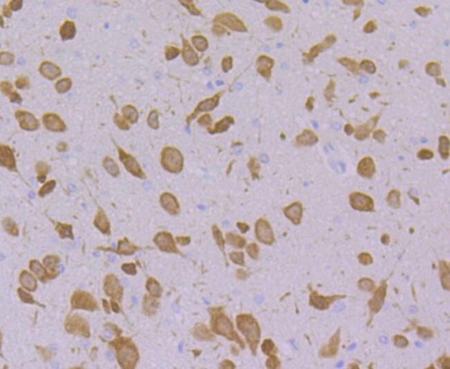 FBXO5 Antibody in Immunohistochemistry (Paraffin) (IHC (P))