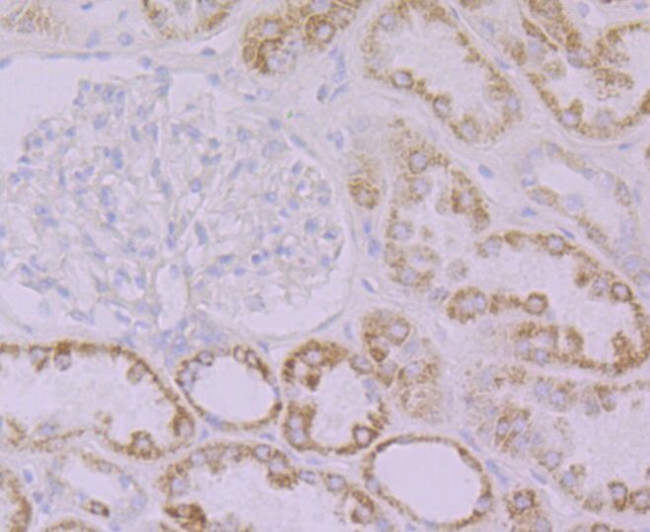 FBXO5 Antibody in Immunohistochemistry (Paraffin) (IHC (P))