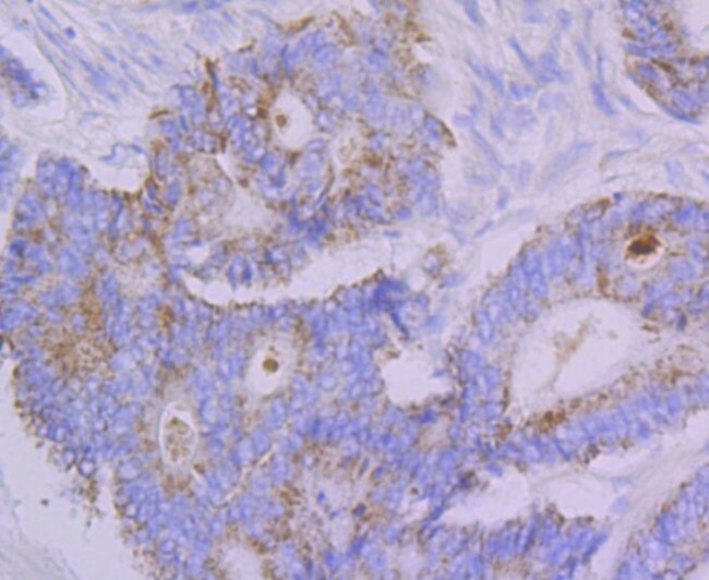 FBXO5 Antibody in Immunohistochemistry (Paraffin) (IHC (P))