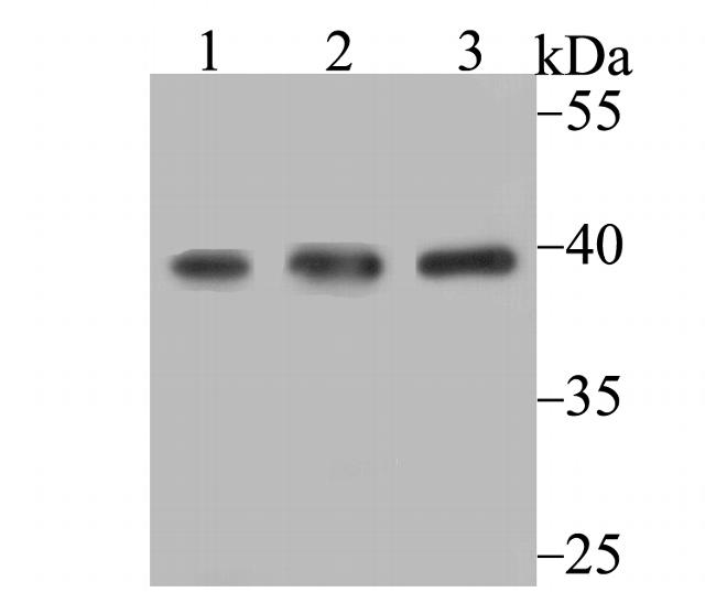 SAE1 Antibody in Western Blot (WB)