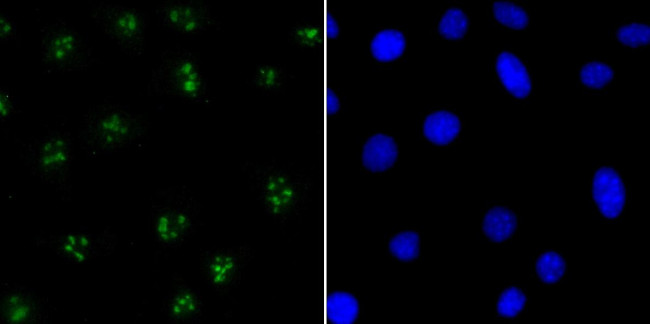 CENPC Antibody in Immunocytochemistry (ICC/IF)