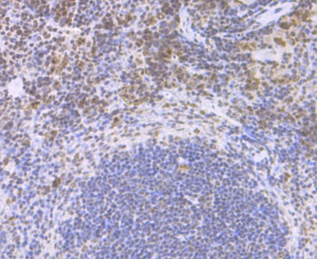 CENPC Antibody in Immunohistochemistry (Paraffin) (IHC (P))