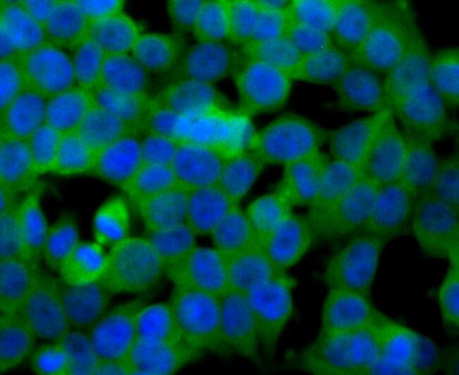 SULT2A1 Antibody in Immunocytochemistry (ICC/IF)