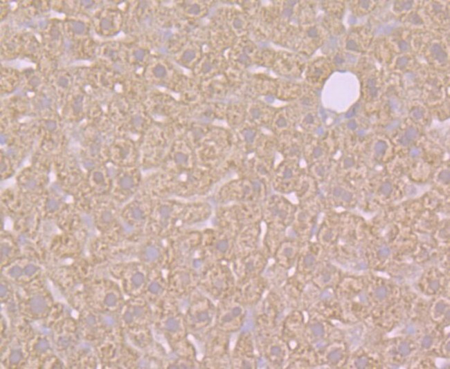 SULT2A1 Antibody in Immunohistochemistry (Paraffin) (IHC (P))