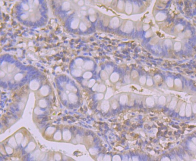 SULT2A1 Antibody in Immunohistochemistry (Paraffin) (IHC (P))