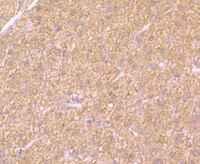 SULT2A1 Antibody in Immunohistochemistry (Paraffin) (IHC (P))