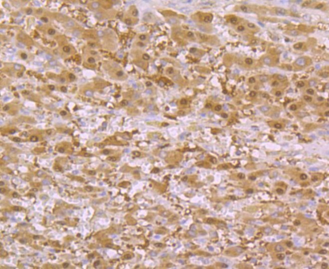 SULT2A1 Antibody in Immunohistochemistry (Paraffin) (IHC (P))