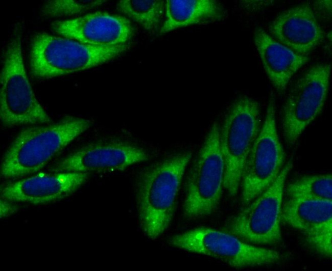 UQCRFS1 Antibody in Immunocytochemistry (ICC/IF)