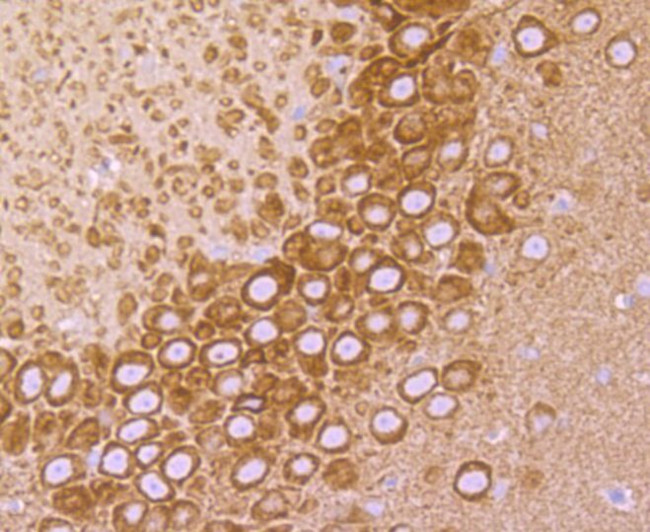 VAMP3 Antibody in Immunohistochemistry (Paraffin) (IHC (P))