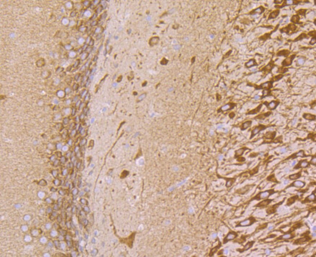 VAMP3 Antibody in Immunohistochemistry (Paraffin) (IHC (P))