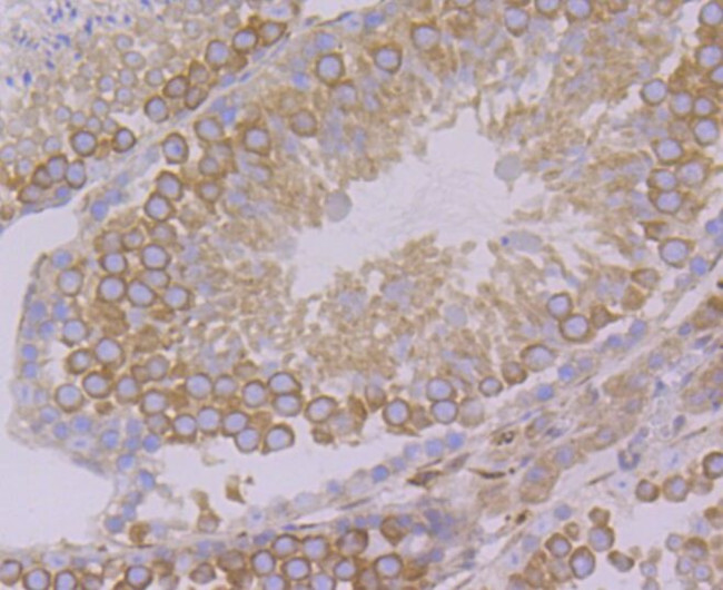 VAMP3 Antibody in Immunohistochemistry (Paraffin) (IHC (P))