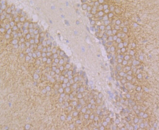 GEF-H1 Antibody in Immunohistochemistry (Paraffin) (IHC (P))