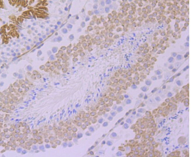 GEF-H1 Antibody in Immunohistochemistry (Paraffin) (IHC (P))