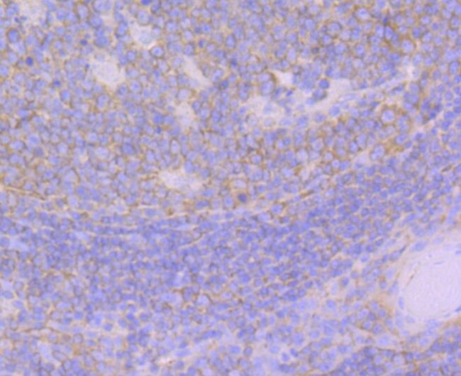 GEF-H1 Antibody in Immunohistochemistry (Paraffin) (IHC (P))