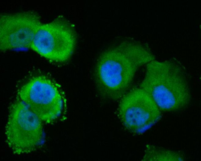 p53DINP1 Antibody in Immunocytochemistry (ICC/IF)