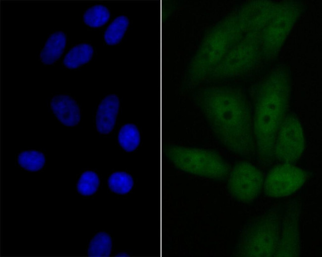 p53DINP1 Antibody in Immunocytochemistry (ICC/IF)