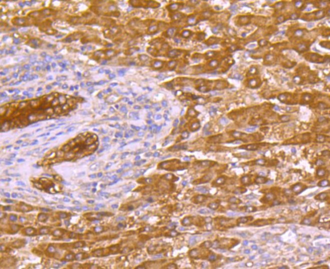 p53DINP1 Antibody in Immunohistochemistry (Paraffin) (IHC (P))