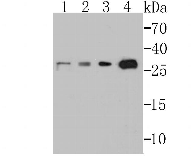 p53DINP1 Antibody in Western Blot (WB)