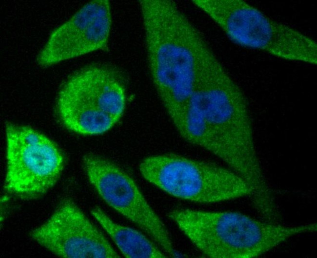 SOCS2 Antibody in Immunocytochemistry (ICC/IF)