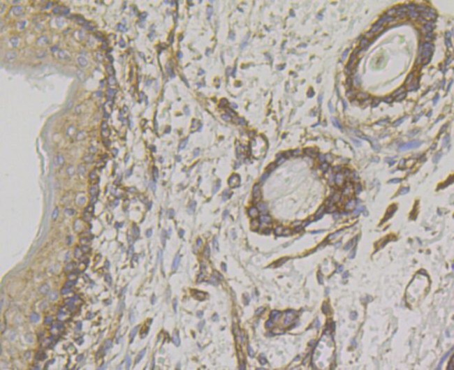 WNK1 Antibody in Immunohistochemistry (Paraffin) (IHC (P))