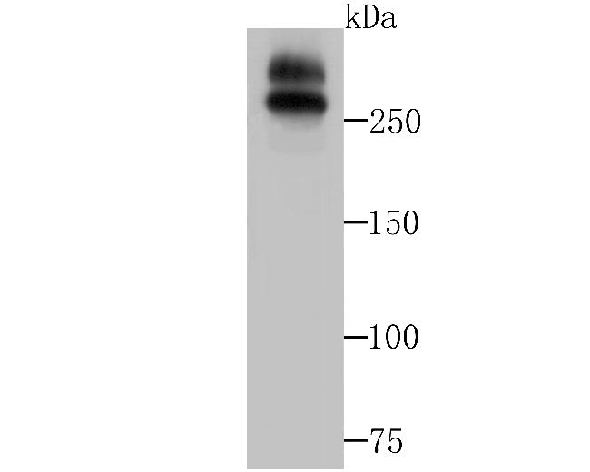 WNK1 Antibody in Western Blot (WB)