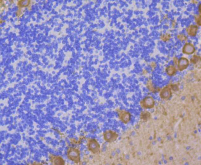 PKC gamma Antibody in Immunohistochemistry (Paraffin) (IHC (P))