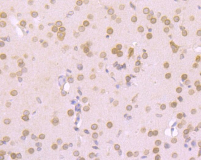 RANGAP1 Antibody in Immunohistochemistry (Paraffin) (IHC (P))