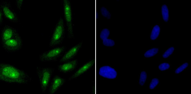 ILF3 Antibody in Immunocytochemistry (ICC/IF)