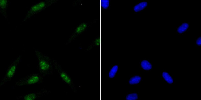 ILF3 Antibody in Immunocytochemistry (ICC/IF)