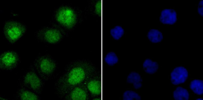 ILF3 Antibody in Immunocytochemistry (ICC/IF)