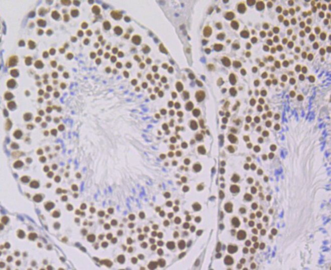 ILF3 Antibody in Immunohistochemistry (Paraffin) (IHC (P))