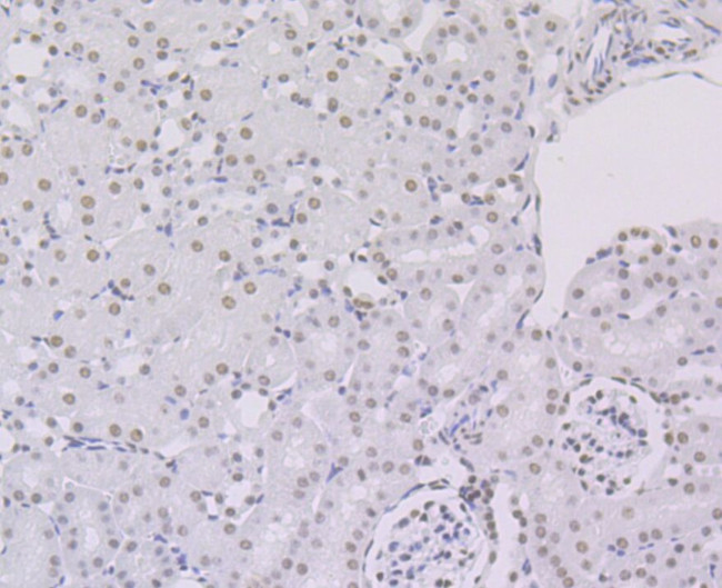 ILF3 Antibody in Immunohistochemistry (Paraffin) (IHC (P))