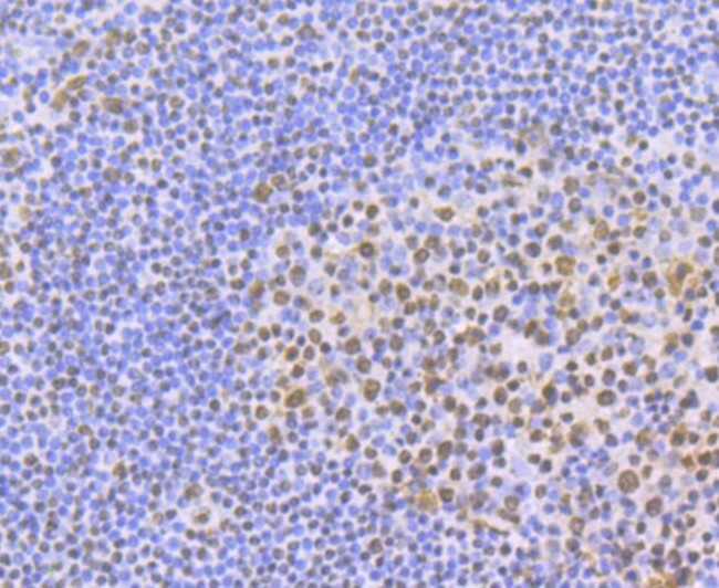 ILF3 Antibody in Immunohistochemistry (Paraffin) (IHC (P))